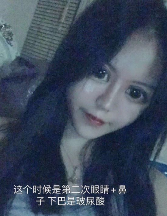 奇异果app：上海00后整容狂人：2年花400万“削骨”目前样子大变却悔怨不已(图9)