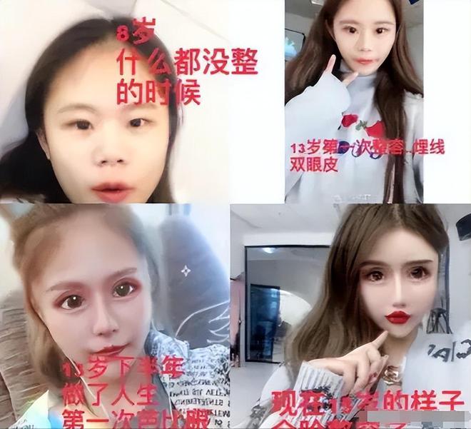 奇异果app：上海00后整容狂人：2年花400万“削骨”目前样子大变却悔怨不已(图19)