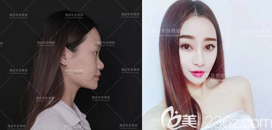 奇异果app：北京沃尔医疗美容暑期蜕变季整形行动即将开启！价钱20000元妍丽基金免费送(图2)