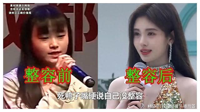 奇异果app官网下载：整容前嘴硬否定自身没整容还真拿观众当傻子？(图1)